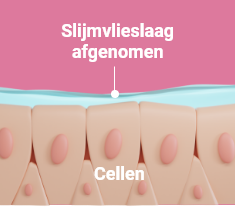 irritatie van de keel irritatie van de keel
